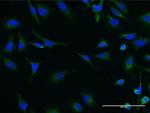 SIK2 Monoclonal Antibody (4C6)