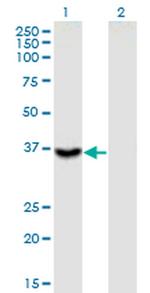 ITGB1BP2 Monoclonal Antibody (3G9)