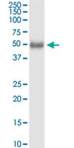 DHH Monoclonal Antibody (2G5)