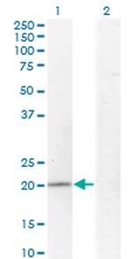 TPRKB Antibody in Western Blot (WB)