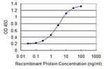 TRIM17 Antibody in ELISA (ELISA)