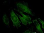 TRAPPC4 Monoclonal Antibody (2D5)