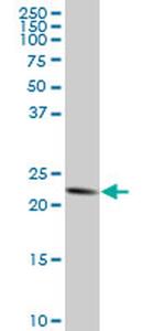 TRAPPC4 Antibody in Western Blot (WB)