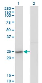 GINS2 Monoclonal Antibody (3H4)
