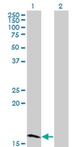 ZNF44 Antibody in Western Blot (WB)