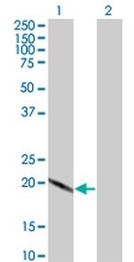 SCAND2P Antibody in Western Blot (WB)