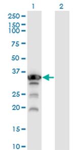 Aprataxin Monoclonal Antibody (2H6)