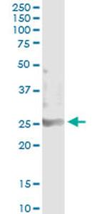 SOHLH2 Monoclonal Antibody (1E1)