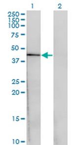 CENPJ Monoclonal Antibody (1A5)