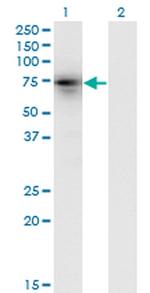 KLHL4 Antibody in Western Blot (WB)