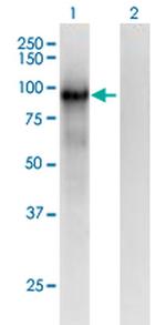 PCDHB6 Monoclonal Antibody (2G11)