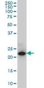 SPRYD7 Monoclonal Antibody (2G4)