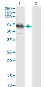 TSKS Monoclonal Antibody (2E9)