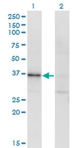RBKS Monoclonal Antibody (3B4)