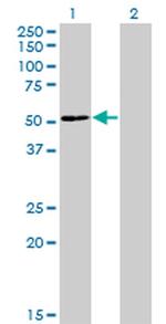 ZNF323 Antibody in Western Blot (WB)