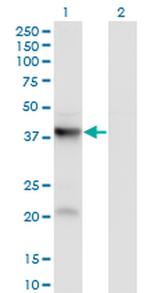 PANK3 Monoclonal Antibody (3D7)