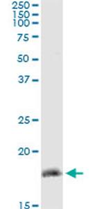 ZMAT4 Antibody in Immunoprecipitation (IP)
