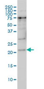 PRKRIP1 Antibody in Western Blot (WB)