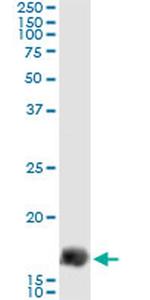Gemin 7 Antibody in Immunoprecipitation (IP)