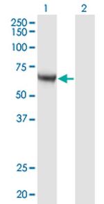 CaMKK alpha Antibody in Western Blot (WB)