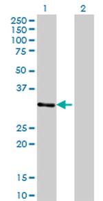 ZNF397 Antibody in Western Blot (WB)