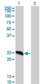 DYDC2 Monoclonal Antibody (8G4)