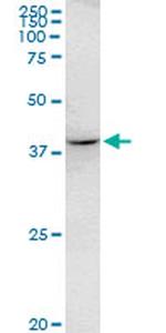 RHOXF2 Monoclonal Antibody (3C4)