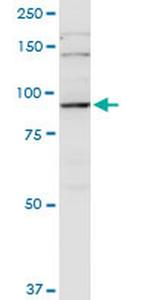 PGBD1 Monoclonal Antibody (2A3)