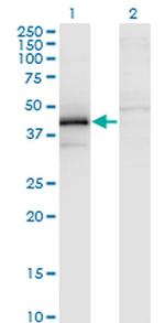 ZFYVE19 Monoclonal Antibody (3G4-2B11)