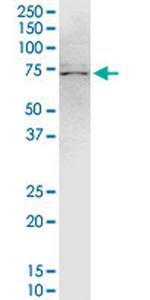 TRIM47 Antibody in Western Blot (WB)