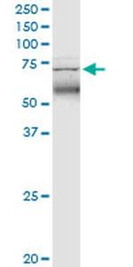 TRIM47 Antibody in Western Blot (WB)