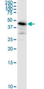 ARMC6 Antibody in Western Blot (WB)