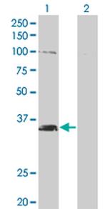 MSI2 Antibody in Western Blot (WB)
