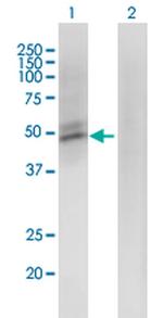 ACMSD Monoclonal Antibody (3A9)