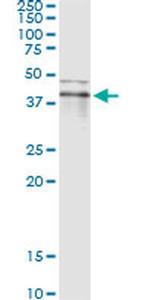 RNF113B Monoclonal Antibody (2B11)