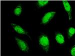 C18orf23 Monoclonal Antibody (3A1)