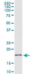 C18orf23 Antibody in Western Blot (WB)