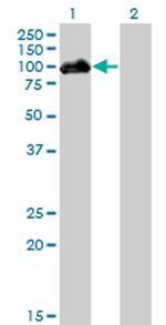 HIPK4 Antibody in Western Blot (WB)