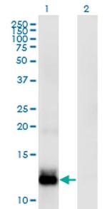 WFDC5 Monoclonal Antibody (5G5)