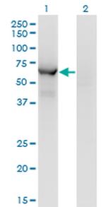 CESK1 Monoclonal Antibody (1G8)