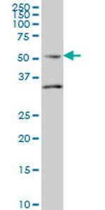 Septin-10 Antibody in Western Blot (WB)