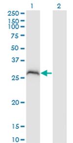 PPP1R2P3 Antibody in Western Blot (WB)
