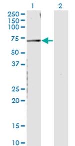 CNKSR3 Antibody in Western Blot (WB)