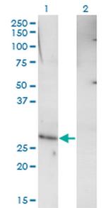 RHOXF1 Antibody in Western Blot (WB)