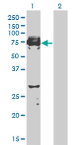 STKLD1 Antibody in Western Blot (WB)