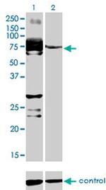 STKLD1 Monoclonal Antibody (2B5)