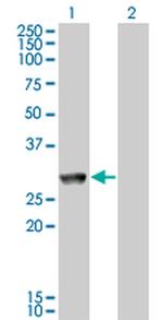 GK5 Monoclonal Antibody (2C11)