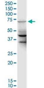 UBE2DNL Monoclonal Antibody (2F7)