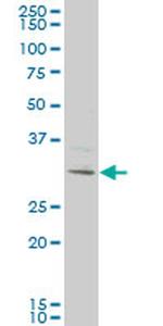 KCTD4 Antibody in Western Blot (WB)