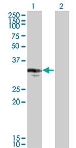 CENPP Monoclonal Antibody (3G8)